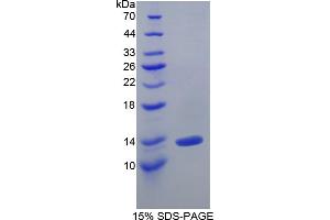 SDS-PAGE analysis of Human IL10Ra Protein. (IL-10RA Protéine)