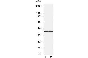 Western blot testing of IGFBP1 antibody and Lane 1:  SMMC-7721;  2: MCF-7 cell lysate (IGFBPI anticorps  (Middle Region))