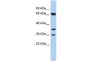 WB Suggested Anti-RYBP Antibody Titration:  0. (RYBP anticorps  (N-Term))