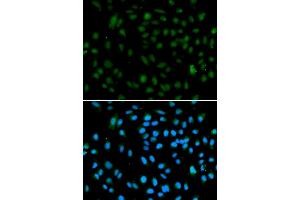 Immunofluorescence analysis of A549 cells using WHSC1L1 antibody (ABIN5973250). (WHSC1L1 anticorps)