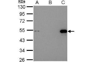 IP Image Immunoprecipitation of p53 protein.