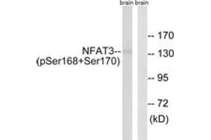 Western Blotting (WB) image for anti-Nuclear Factor of Activated T-Cells, Cytoplasmic, Calcineurin-Dependent 4 (NFATC4) (AA 136-185), (pSer168) antibody (ABIN482772) (NFATC4 anticorps  (pSer168))