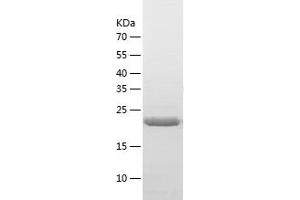 Western Blotting (WB) image for BCL2-Like 1 (BCL2L1) (AA 1-209) protein (His-IF2DI Tag) (ABIN7121986)