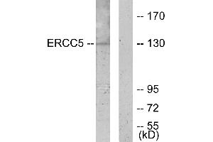 Western blot analysis of extracts from K562 cells, using ERCC5 antibody. (ERCC5 anticorps  (Internal Region))