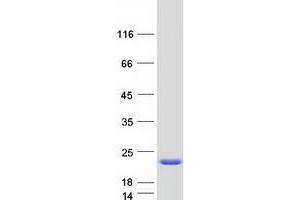 Validation with Western Blot