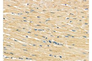ABIN6262032 and ABIN6278985 at 1/100 staining Rat heart tissue by IHC-P. (GOLT1B anticorps  (C-Term))