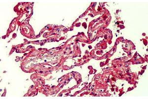 Human Lung: Formalin-Fixed, Paraffin-Embedded (FFPE)