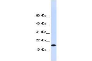PHLDA3 antibody used at 1 ug/ml to detect target protein. (PHLDA3 anticorps  (N-Term))