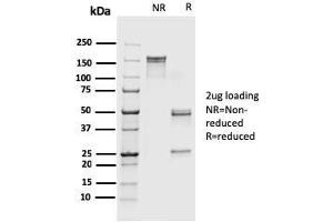 SDS-PAGE Analysis Purified S100A4 Recombinant Mouse Monoclonal Antibody (rS100A4/1481).