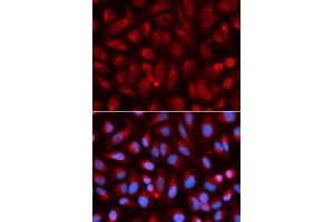 Immunofluorescence analysis of U2OS cells using ADA antibody. (ADA anticorps)
