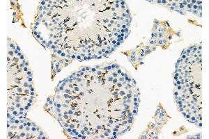 ABIN6266305 and ABIN6277424 at 1/100 staining Mouse testis tissue by IHC-P. (PDK4 anticorps  (C-Term))