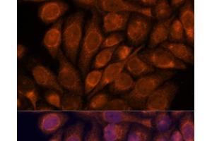 Immunofluorescence analysis of HeLa cells using IPO4 Polyclonal Antibody at dilution of 1:100. (Importin 4 anticorps)
