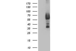 Western Blotting (WB) image for anti-Dystrobrevin, beta (DTNB) antibody (ABIN1497916) (Dystrobrevin beta anticorps)