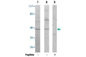 Western blot analysis of extracts from Jurkat cells (Lane 1) and COLO 205 cells (Lane 2 and lane 3), using ACTL6A polyclonal antibody .