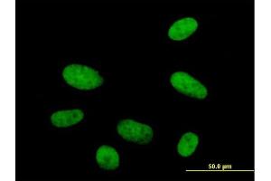 Immunofluorescence of  purified  MaxPab antibody to HMG20A on HepG2 cell.