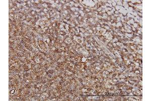 Immunoperoxidase of monoclonal antibody to PTGIR on formalin-fixed paraffin-embedded human tonsil.
