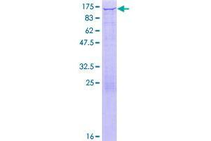 Hexokinase 1 (HK1) (AA 1-916) protein (GST tag)