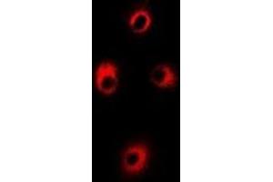 Immunofluorescent analysis of ALAS-H staining in Hela cells. (ALAS1 anticorps)