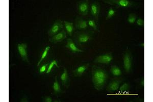 Immunofluorescence of monoclonal antibody to STK4 on HeLa cell. (STK4 anticorps  (AA 1-39))