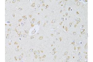 Immunohistochemistry of paraffin-embedded rat brain using NTS antibody (ABIN6290694) at dilution of 1:100 (40x lens). (Neurotensin anticorps)