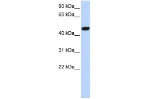 WB Suggested Anti-CACNB4 Antibody Titration:  0.