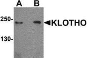 Western blot analysis of KLOTHO in rat heart tissue lysate with KLOTHO antibody at (A) 1 and (B) 2 μg/ml.