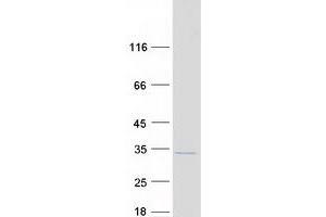 Validation with Western Blot
