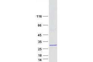 Validation with Western Blot