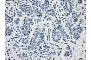 Immunohistochemical staining of paraffin-embedded breast tissue using anti-PPP5C mouse monoclonal antibody. (PP5 anticorps)