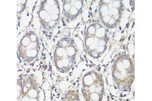 Immunohistochemistry of paraffin-embedded Human colon using FAK Polyclonal Antibody at dilution of 1:100 (40x lens). (FAK anticorps)