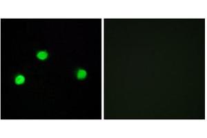 Immunofluorescence (IF) image for anti-Inositol Hexakisphosphate Kinase 2 (IP6K2) (Internal Region) antibody (ABIN1850058) (IP6K2 anticorps  (Internal Region))