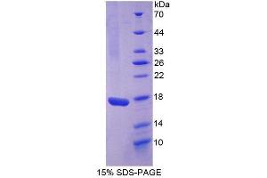 SDS-PAGE (SDS) image for Interleukin 17 (IL17) (AA 21-153) protein (His tag) (ABIN1980633)