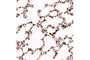 Immunohistochemistry analysis of paraffin-embedded rat placenta using,CLIC6 (ABIN7073478) at dilution of 1: 600