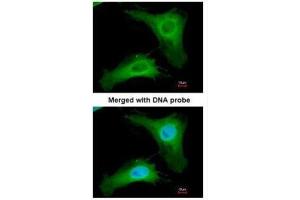 ICC/IF Image Immunofluorescence analysis of paraformaldehyde-fixed HeLa, using PHLP, antibody at 1:200 dilution. (Phosducin-Like anticorps)