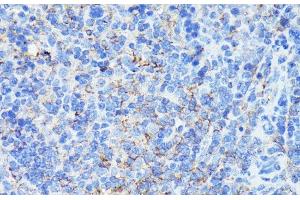 Immunohistochemistry of paraffin-embedded Mouse spleen using MADCAM1 Polyclonal Antibody at dilution of 1:100 (40x lens). (MADCAM1 anticorps)
