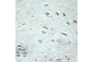 IHC on rat spinal cord using Rabbit antibody to VPS45A  at a concentration of 10 µg/ml.