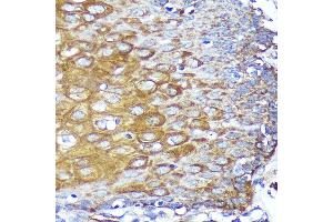 Immunohistochemistry of paraffin-embedded Human esophageal using CYB5R1 Rabbit pAb (ABIN7266630) at dilution of 1:100 (40x lens).