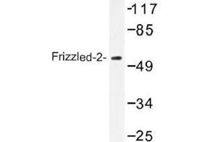 Image no. 1 for anti-Frizzled Family Receptor 2 (FZD2) antibody (ABIN317860) (FZD2 anticorps)