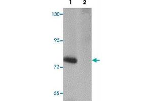 Western blot analysis of SESTD1 in rat brain tissue lysate with SESTD1 polyclonal antibody  at 1 ug/mL in (1) the absence and (2) the presence of blocking peptide.