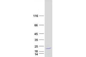Validation with Western Blot