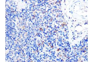 Immunohistochemistry of paraffin-embedded mouse spleen using CD40L Rabbit pAb (ABIN6133614, ABIN6138190, ABIN6138191 and ABIN6216826) at dilution of 1:100 (40x lens). (CD40 Ligand anticorps  (AA 79-129))
