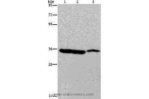 Western blot analysis of Mouse heart, liver and stomach tissue, using MDH1 Polyclonal Antibody at dilution of 1:500 (MDH1 anticorps)