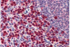 Human Spleen: Formalin-Fixed, Paraffin-Embedded (FFPE)