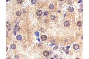 Immunohistochemistry of Il1rl1 in mouse kidney tissue with Il1rl1 polyclonal antibody  at 2 ug/mL . (IL1RL1 anticorps  (N-Term))