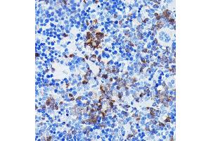 Immunohistochemistry of paraffin-embedded mouse spleen using BTK Rabbit mAb (ABIN7265950) at dilution of 1:100 (40x lens).