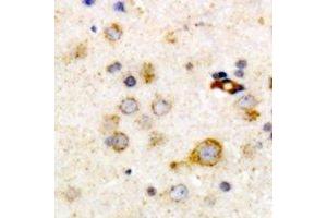 Immunohistochemical analysis of Clusterin staining in human brain formalin fixed paraffin embedded tissue section. (Clusterin anticorps)