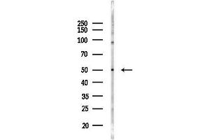 Western blot analysis of lysates from Hela cells(heat-shock 45 min treatment), using HLA-DP Antibody at 1/1000 dilution.