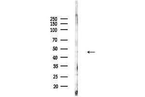 anti-CaMK2 alpha/beta/delta (pThr305) antibody