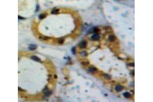 IHC-P analysis of Kidney tissue, with DAB staining. (ACVR1 anticorps  (AA 208-340))