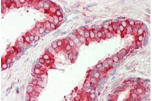 Human Prostate: Formalin-Fixed, Paraffin-Embedded (FFPE)